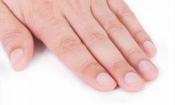 How to treat dry and brittle nails?